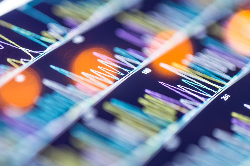 A close up of a digital screen with line graph readouts